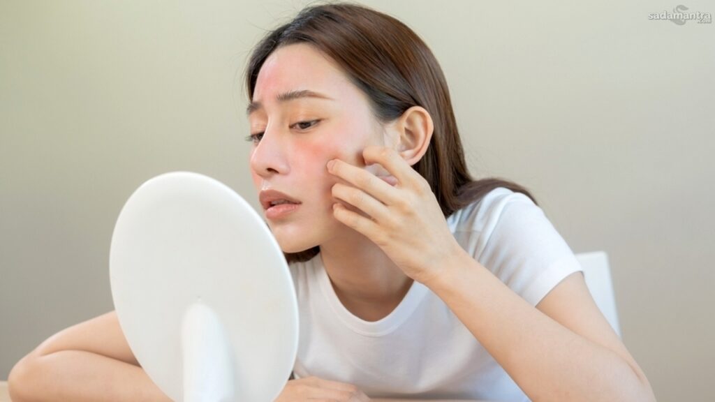 Penggunaan skincare berlebihan bisa sebabkan ruam wajah
